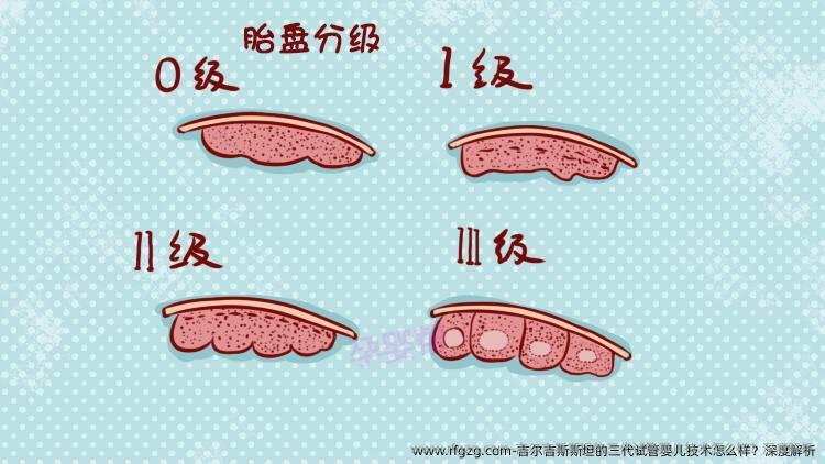 吉尔吉斯斯坦的三代代孕技术怎么样？深度解析