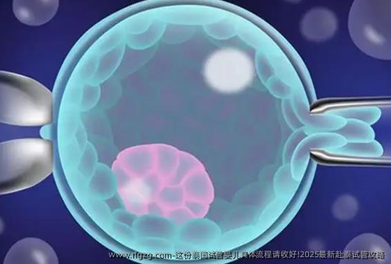 这份泰国代孕具体流程请收好!2025最新赴泰试管攻略