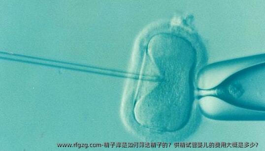 **是如何筛选精子的？特需代孕的费用大概是多少？