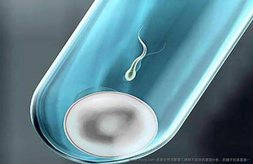 高龄女性代孕精卵不结合的原因分析，抗精子抗体是其一