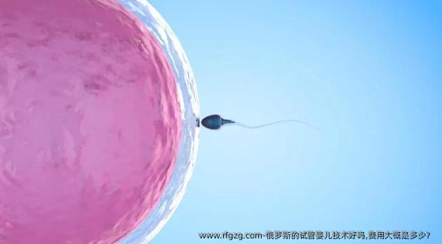 俄罗斯的代孕技术好吗,费用大概是多少？ 